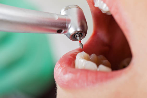 Best Urgent Tooth Repair  in Crosbyton, TX